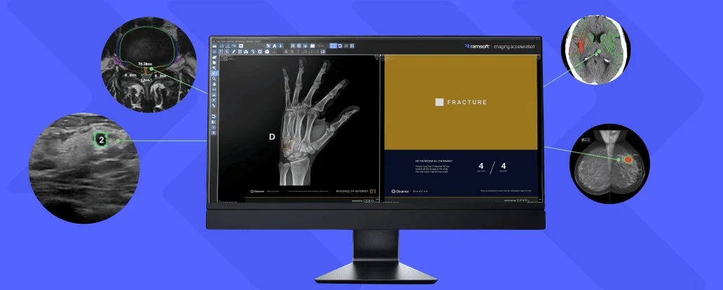 AI systems used in medical diagnosis, like those interpreting MRI scans, are considered 'high-risk' 