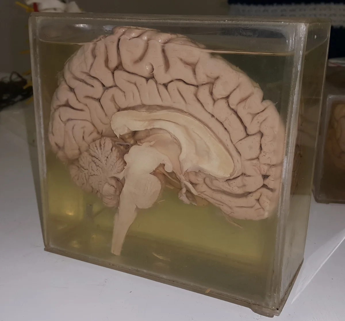 Le cerveau humain, pesant environ 3 livres, est l'organe le plus complexe du corps, responsable de toutes