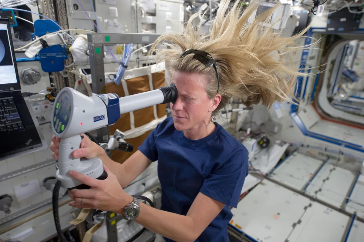Spaceflight-Associated Neuro-ocular Syndrome (SANS) affects up to 70% of astronauts on long-duration